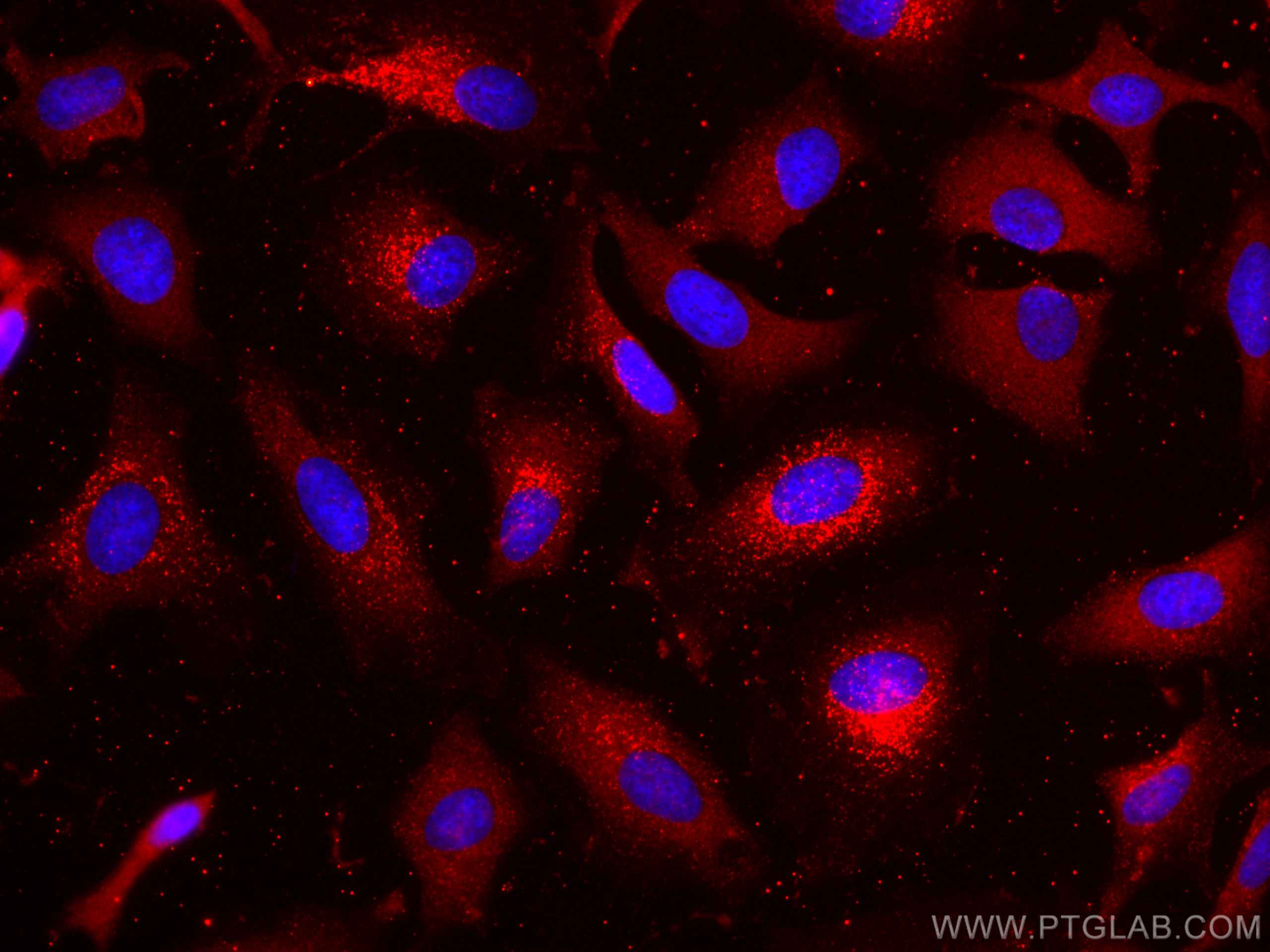 IF Staining of HeLa using CL594-66425