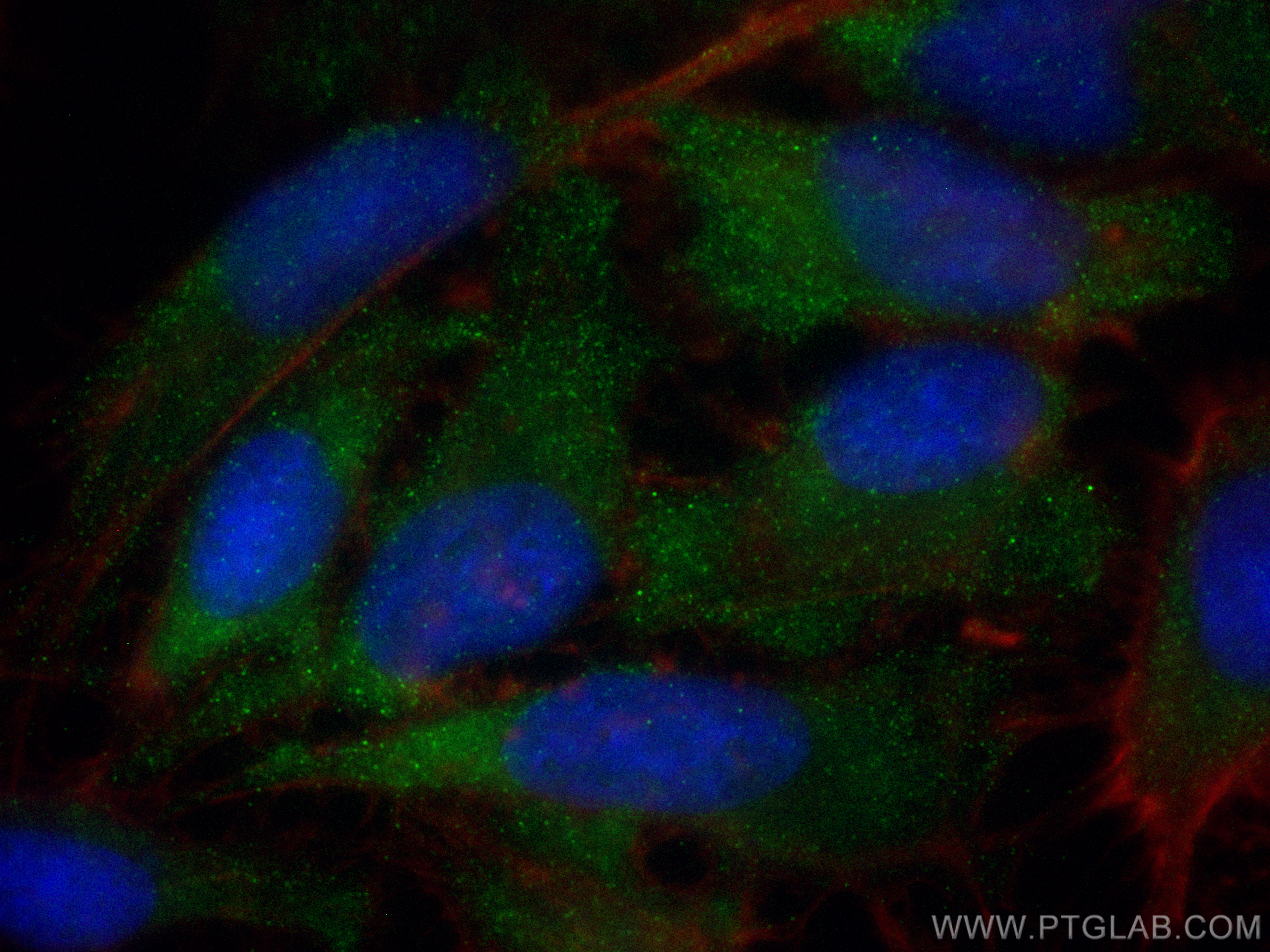 IF Staining of HeLa using 14546-1-AP