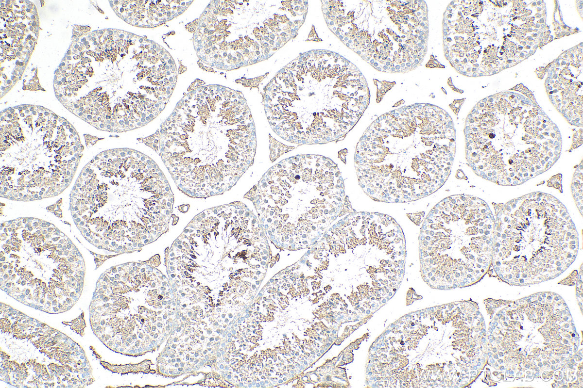 IHC staining of mouse testis using 14546-1-AP