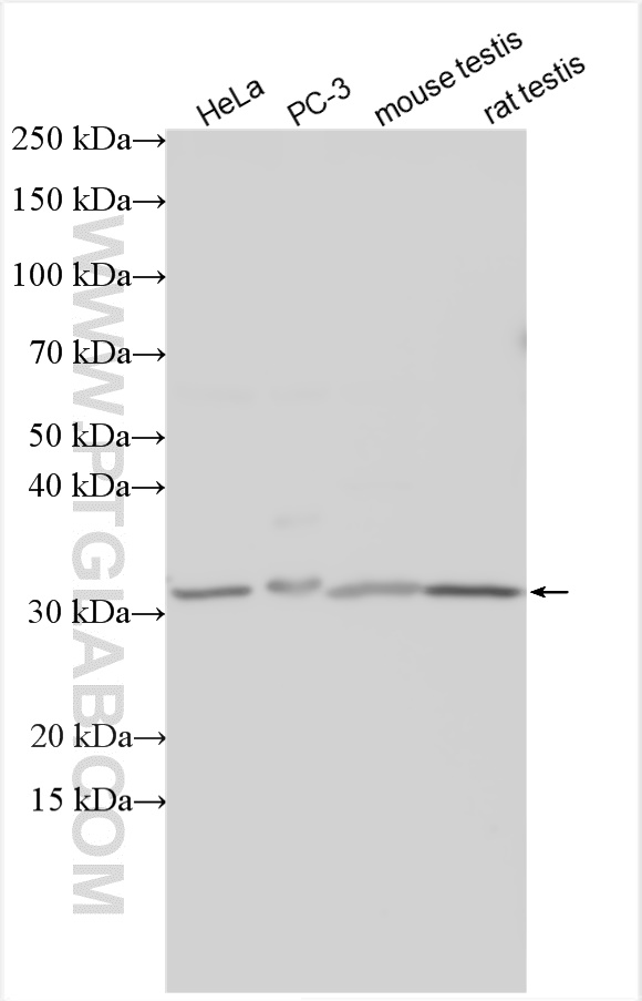 WB analysis using 14546-1-AP