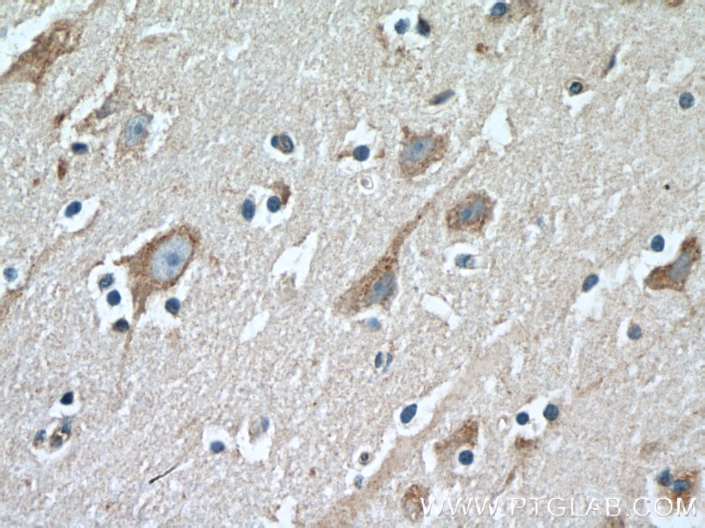 LDLR Polyclonal antibody