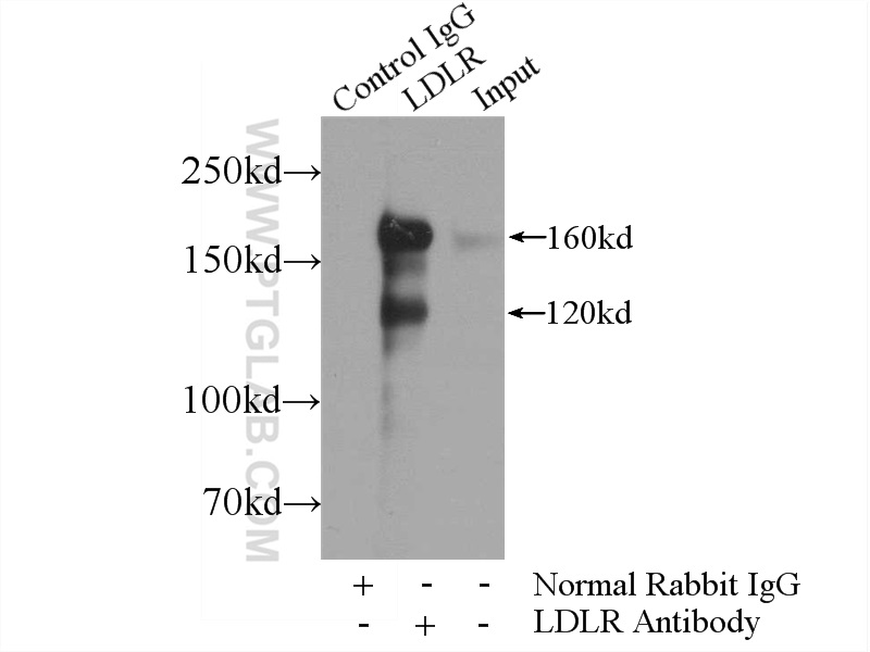 IP experiment of HeLa using 10785-1-AP