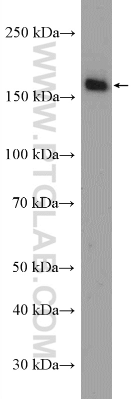 WB analysis of HeLa using 10785-1-AP