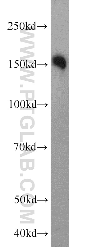 LDLR Polyclonal antibody