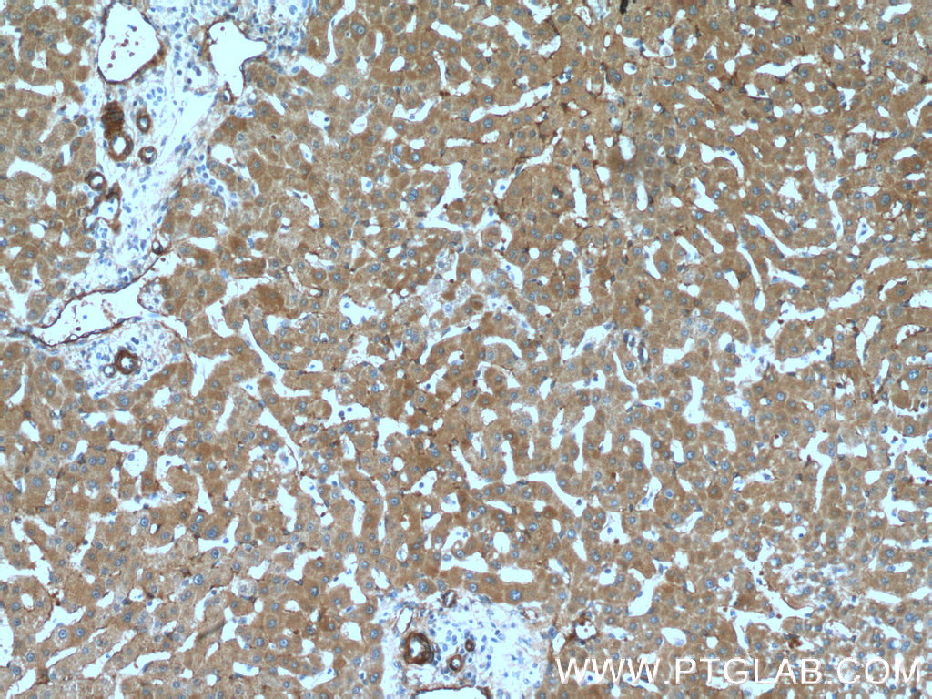 IHC staining of human liver using 66414-1-Ig (same clone as 66414-1-PBS)