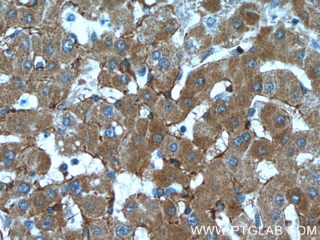 IHC staining of human liver using 66414-1-Ig (same clone as 66414-1-PBS)