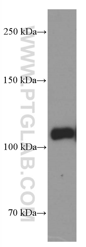 LDLR Monoclonal antibody