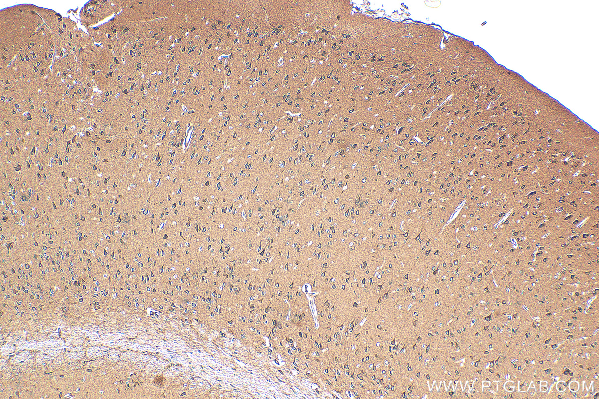 IHC staining of mouse brain using 82724-1-RR (same clone as 82724-1-PBS)