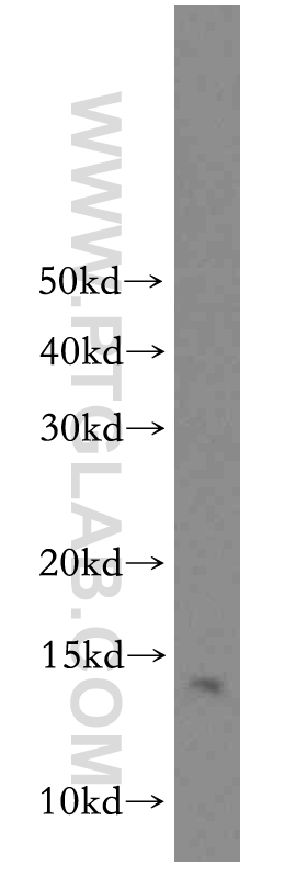 WB analysis of mouse brain using 20096-1-AP