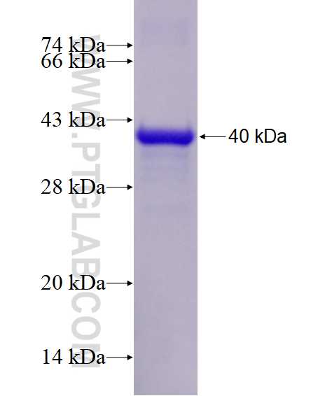 LDLRAP1 fusion protein Ag28608 SDS-PAGE