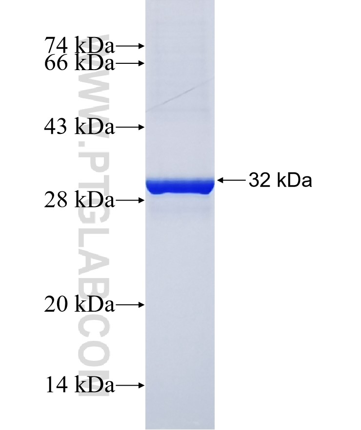 LEAP2 fusion protein Ag37485 SDS-PAGE LEAP2 fusion protein Ag37485 SDS-PAGE