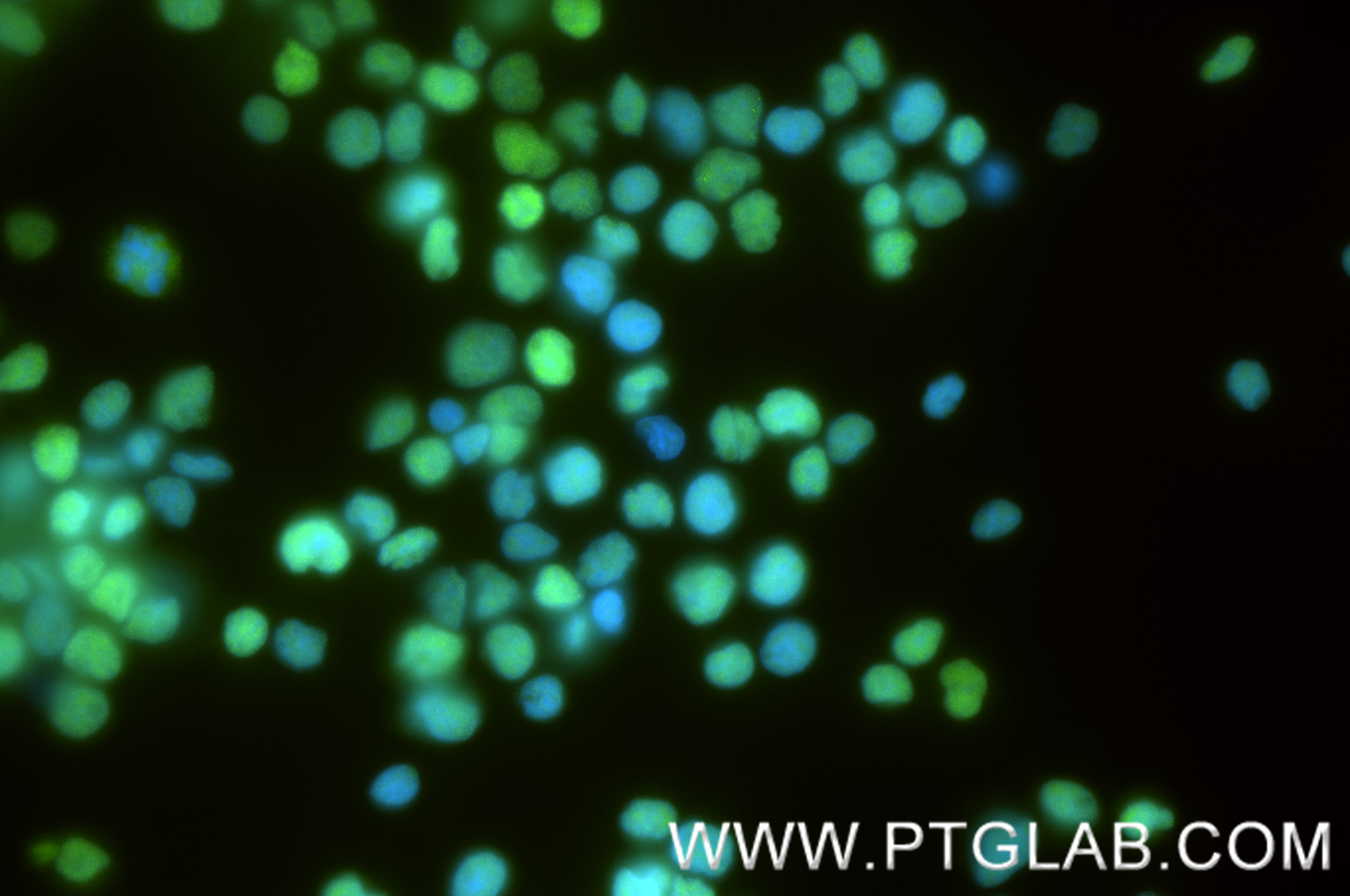 IF Staining of Jurkat using 88437-2-RR (same clone as 88437-2-PBS) IF Staining of Jurkat using 88437-2-RR (same clone as 88437-2-PBS)