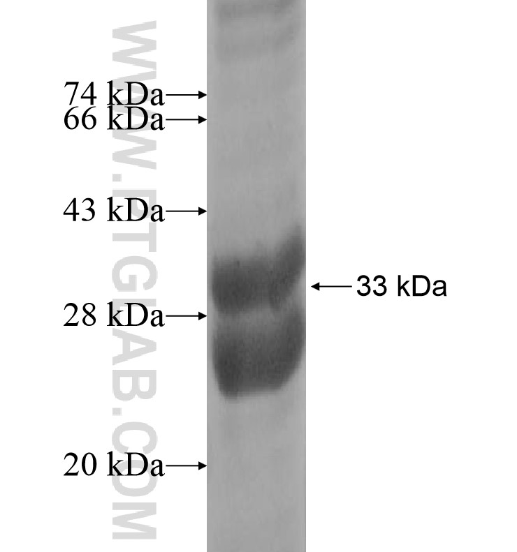 LENEP fusion protein Ag16427 SDS-PAGE LENEP fusion protein Ag16427 SDS-PAGE