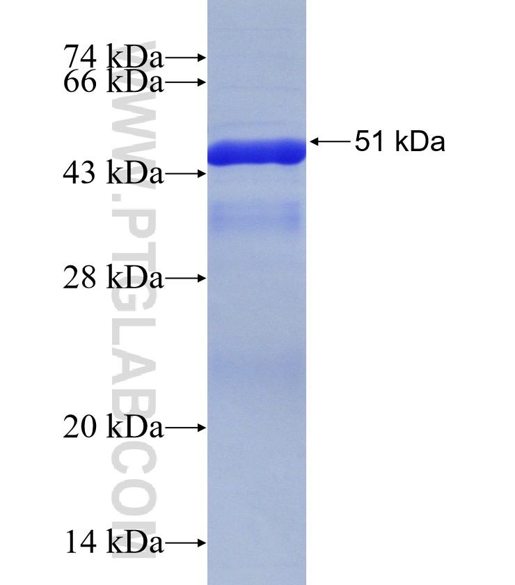 LENG8 fusion protein Ag31464 SDS-PAGE LENG8 fusion protein Ag31464 SDS-PAGE