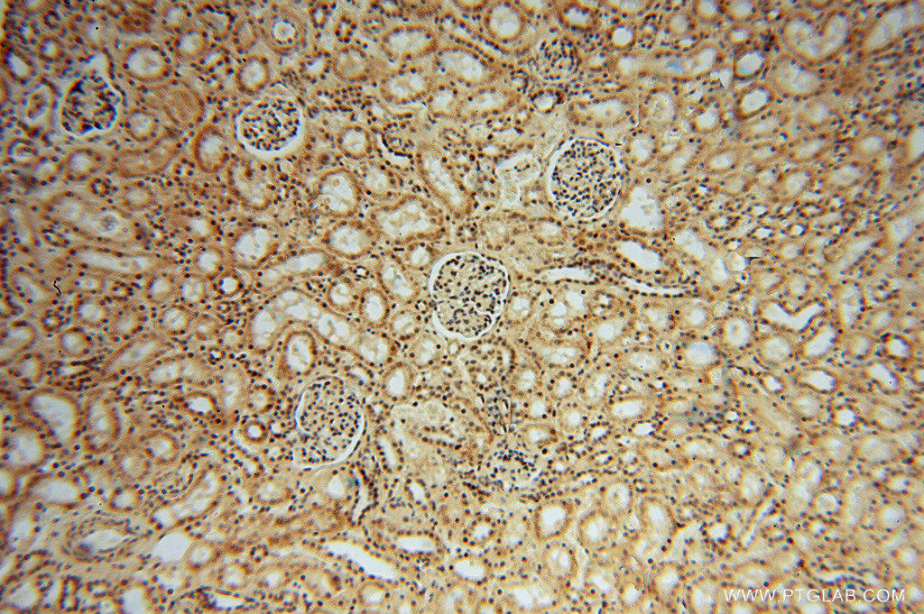 IHC staining of human kidney using 16295-1-AP