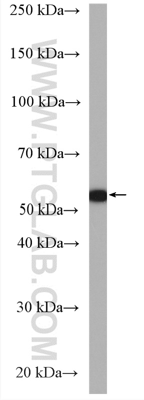 WB analysis of HeLa using 16295-1-AP