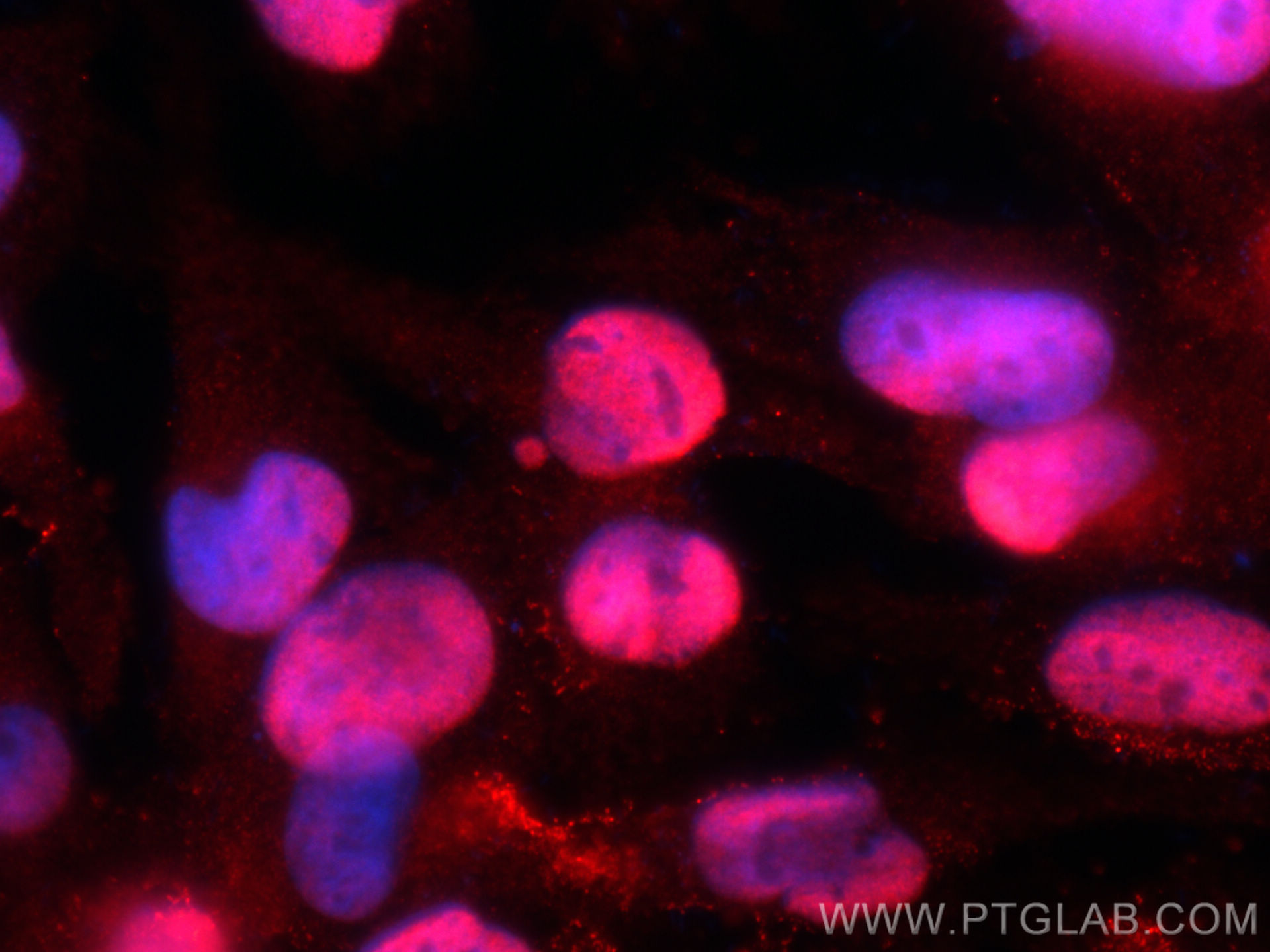 IF Staining of U-251 using 12281-1-AP