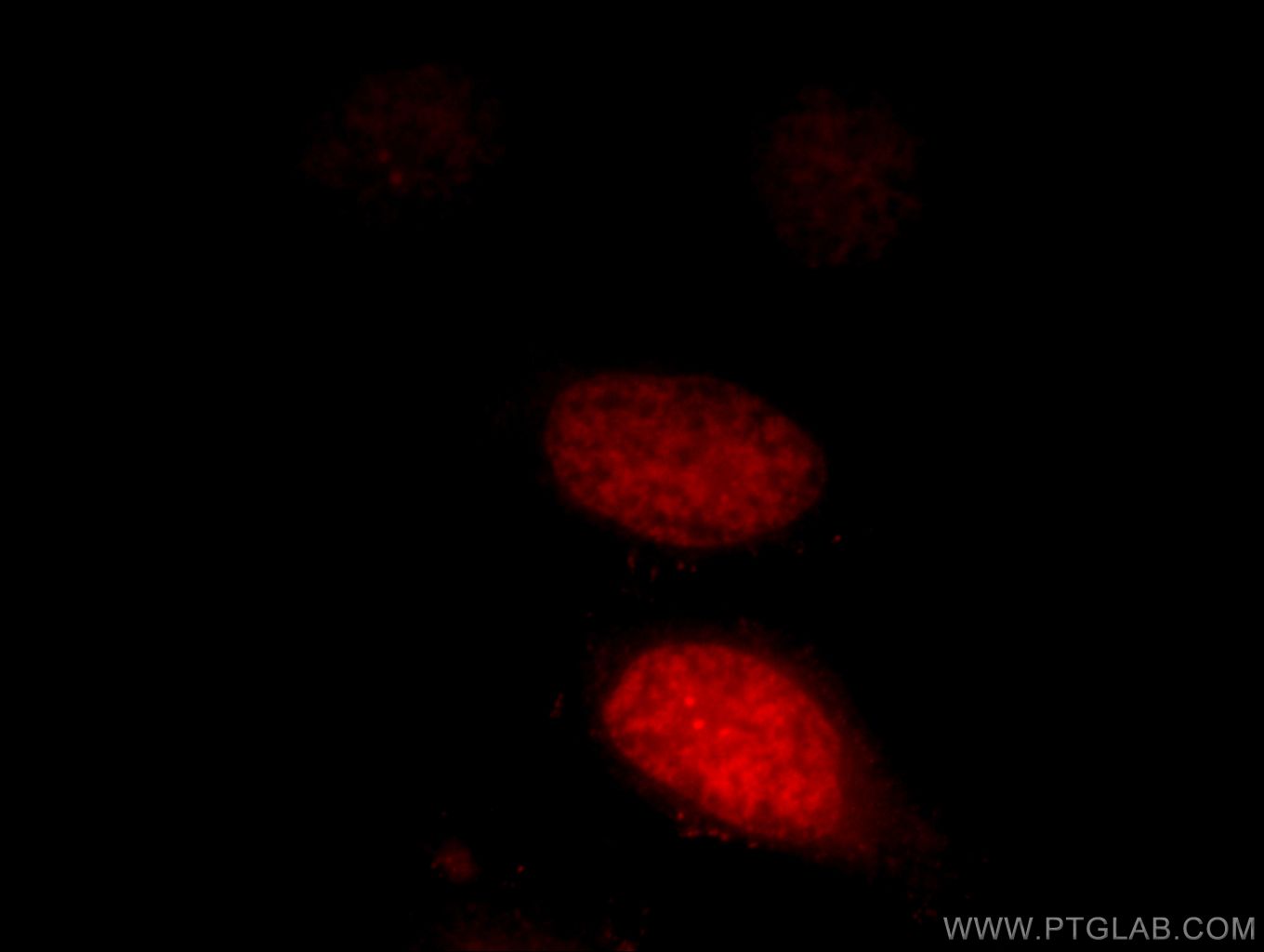 IF Staining of HeLa using 12281-1-AP