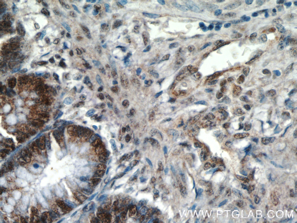 IHC staining of human colon using 12281-1-AP