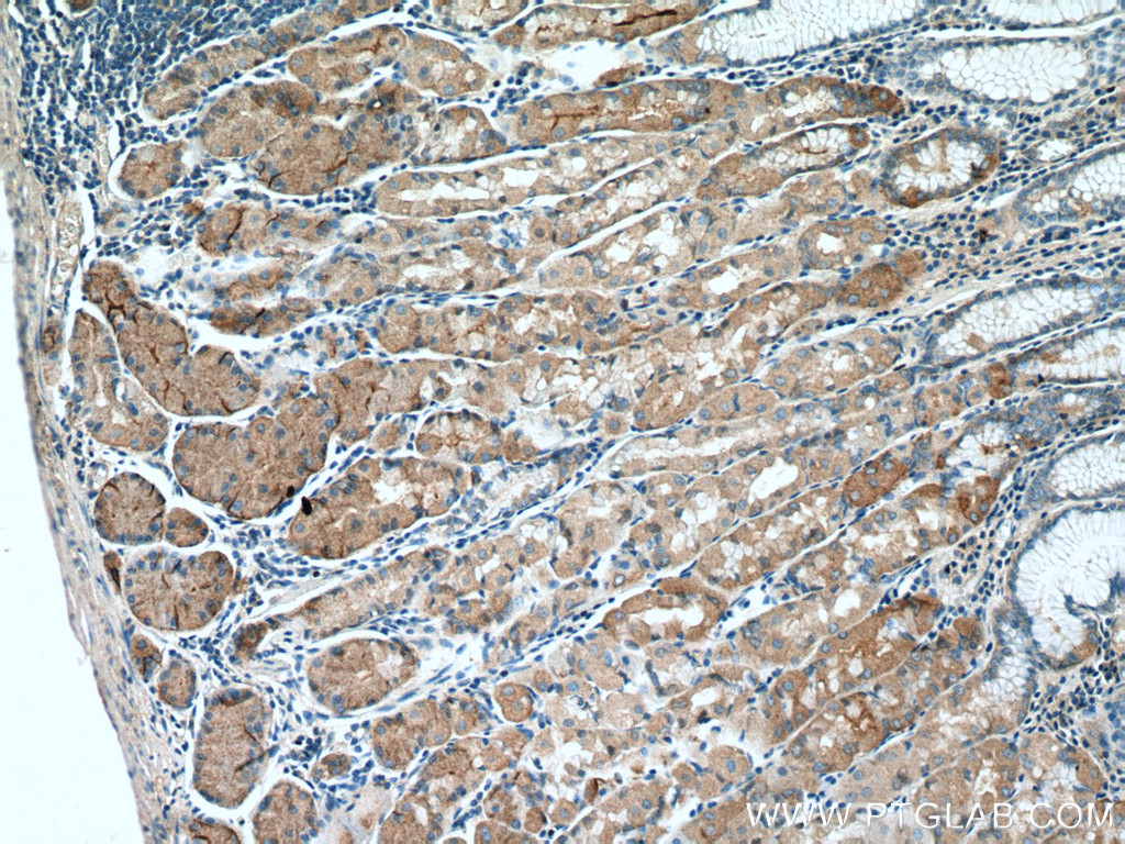 IHC staining of human stomach using 17436-1-AP