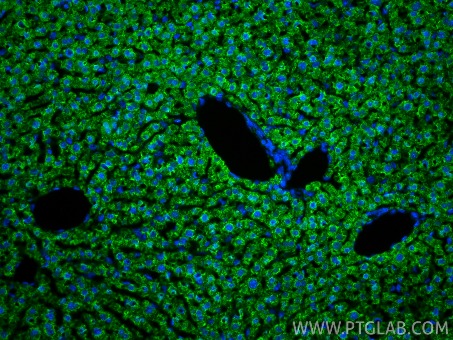 Immunofluorescent analysis of (4% PFA) fixed paraffin-embedded mouse liver tissue using LEPR antibody (20966-1-AP) at dilution of 1:200 and CoraLite®488-Conjugated Goat Anti-Rabbit IgG(H+L) (<a class='green' href='/productredirect?CatalogNo=SA00013-2' target='_blank'>SA00013-2</a>). Heat mediated antigen retrieval with Tris-EDTA buffer (pH 9.0). IF Staining of mouse liver using 20966-1-AP