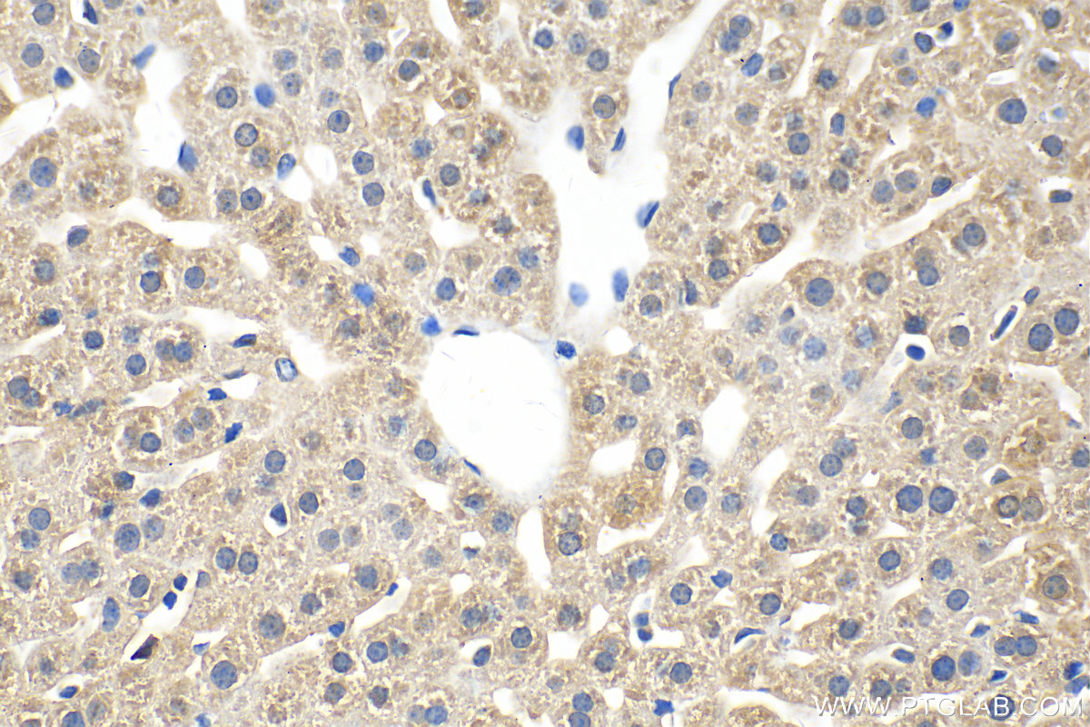 IHC staining of mouse liver using 20966-1-AP