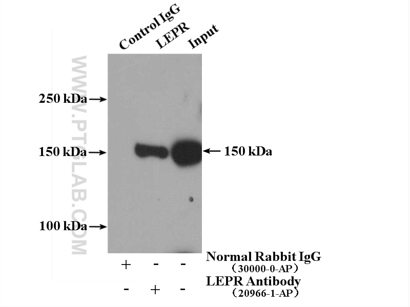 IP experiment of mouse heart using 20966-1-AP