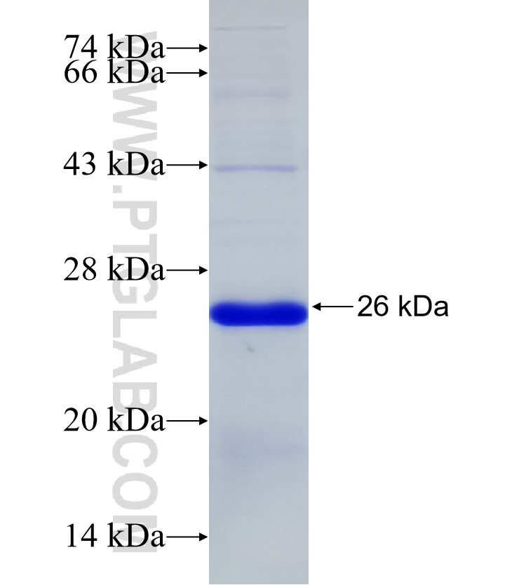 LEPR fusion protein Ag32746 SDS-PAGE LEPR fusion protein Ag32746 SDS-PAGE