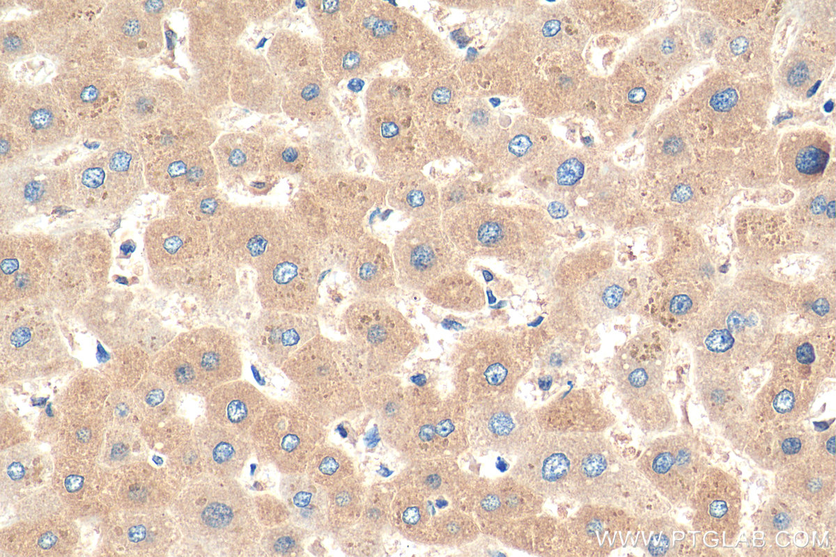 IHC staining of human liver using 15723-1-AP