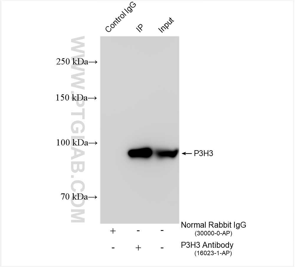 IP experiment of MDA-MB-453 using 16023-1-AP