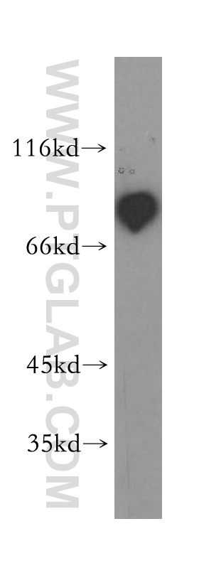 P3H3 Polyclonal antibody