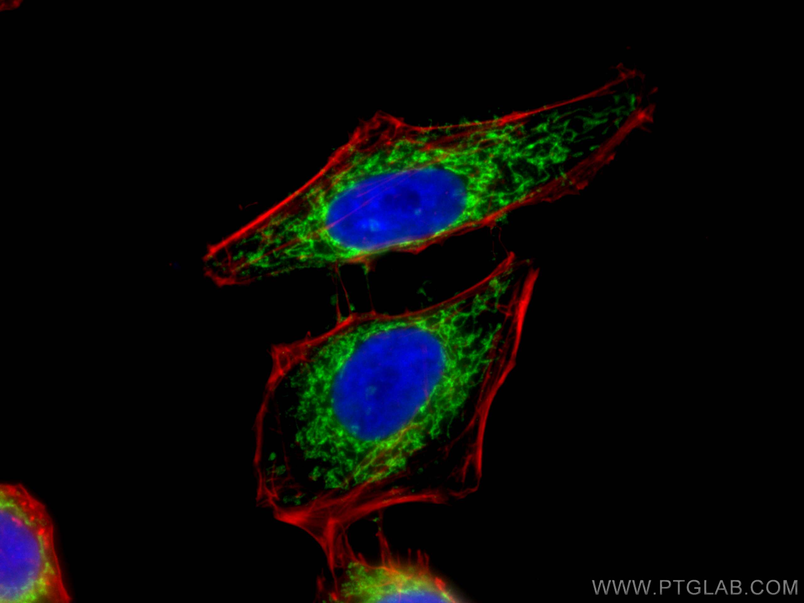 IF Staining of HeLa using 16024-1-AP