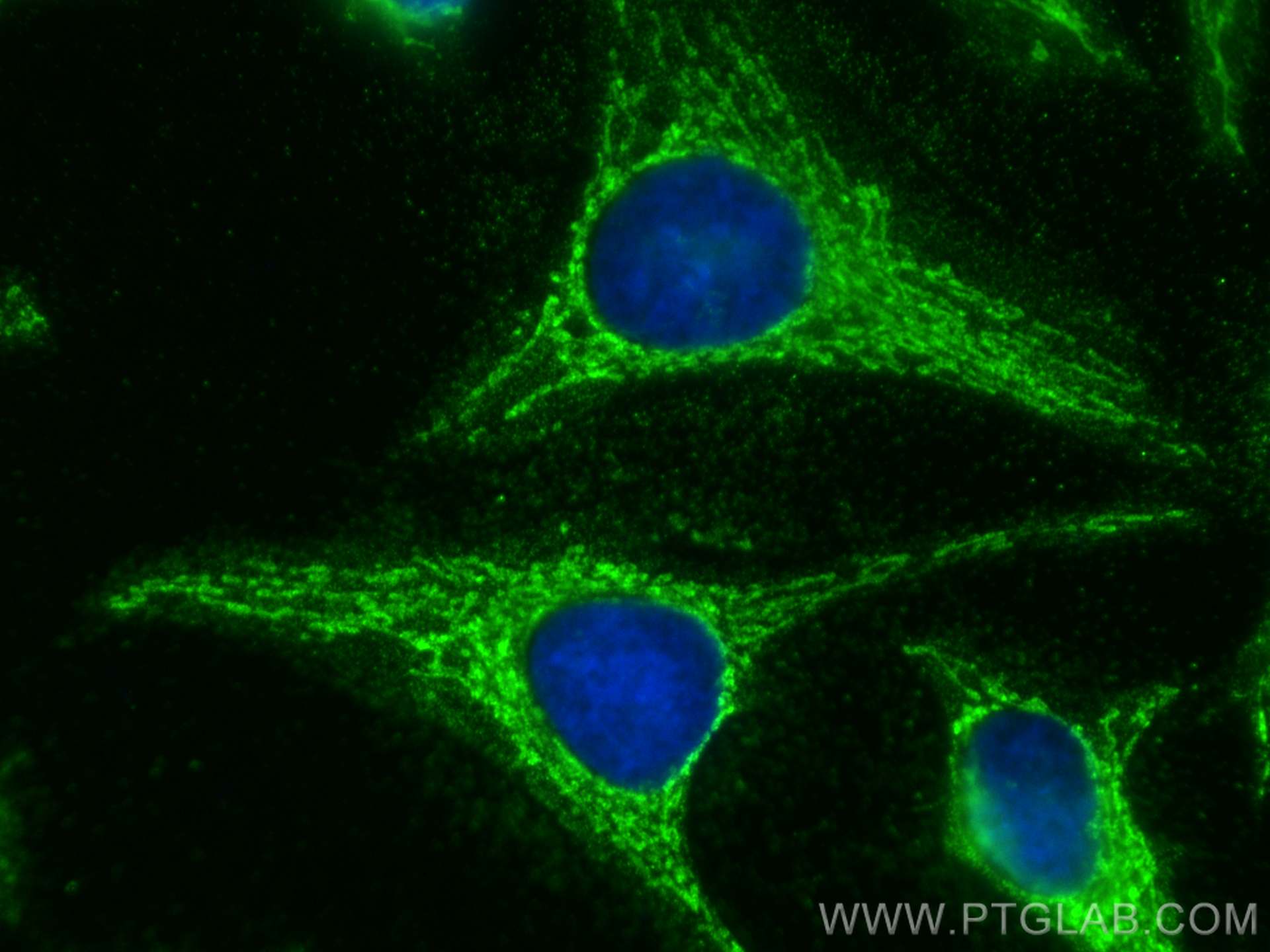 IF Staining of HeLa using 68208-1-Ig (same clone as 68208-1-PBS)
