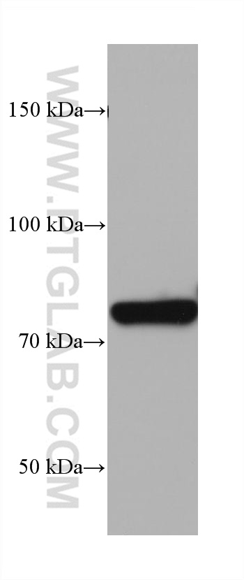 WB analysis of rat heart using 68208-1-Ig (same clone as 68208-1-PBS)