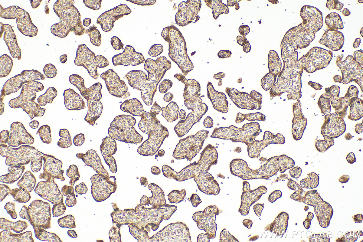 IHC staining of human placenta using 17823-1-AP