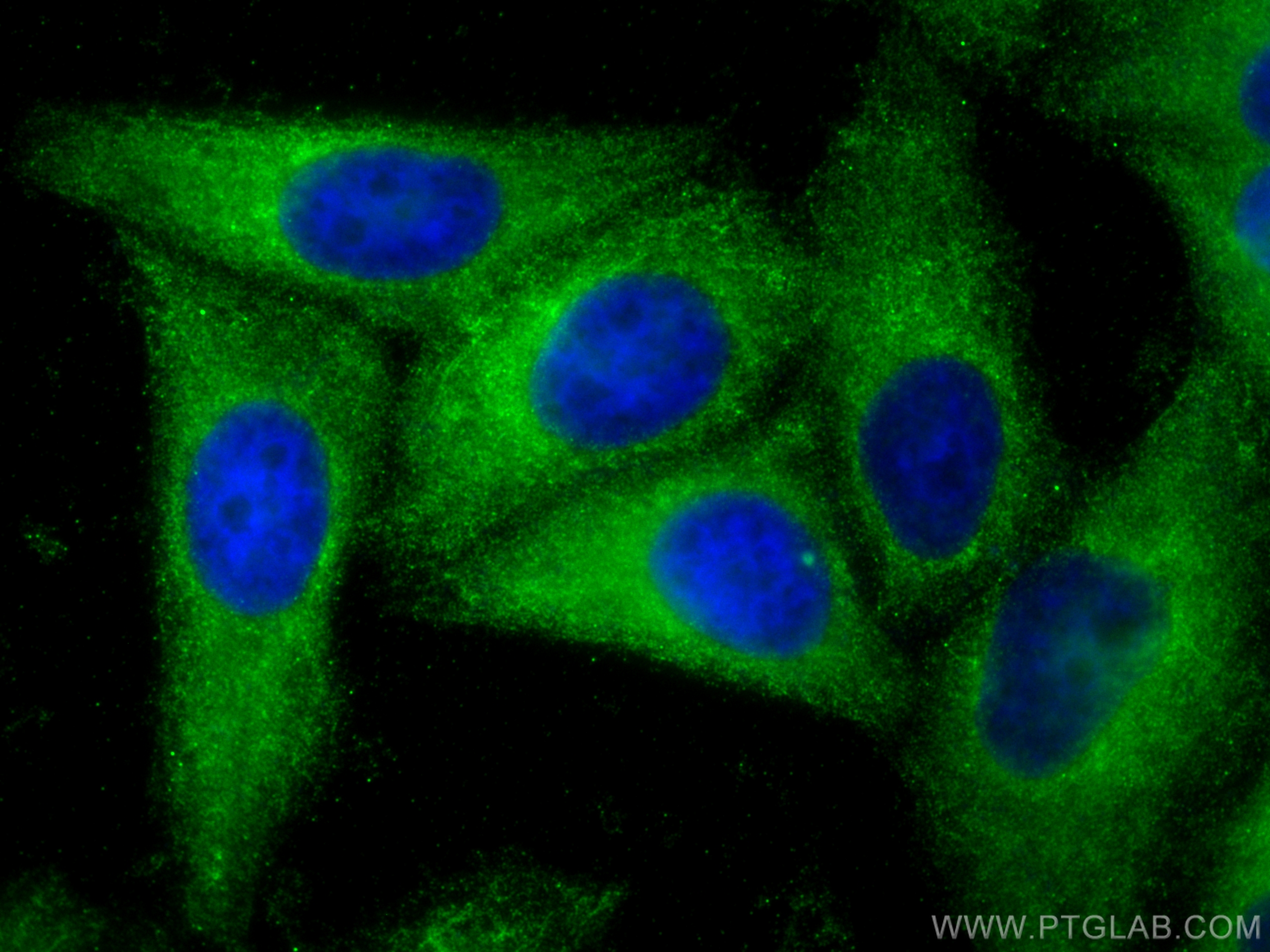 IF Staining of HepG2 using 10281-1-AP
