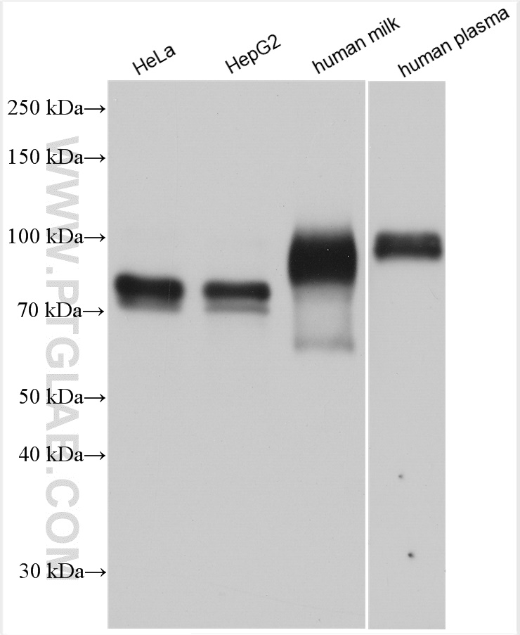 WB analysis using 10281-1-AP