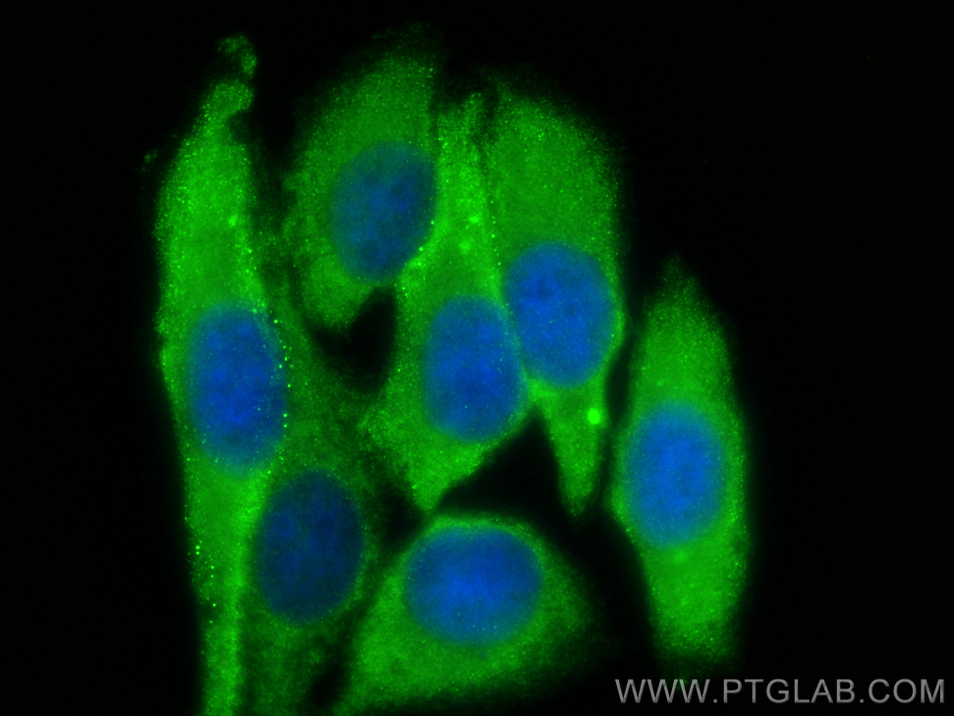 IF Staining of HepG2 using 23307-1-AP