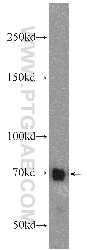 WB analysis of HepG2 using 23307-1-AP