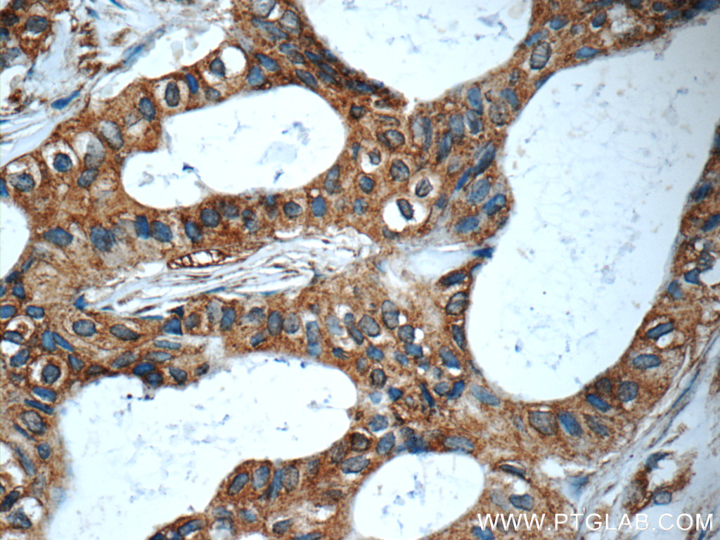 LGALS3BP Monoclonal antibody