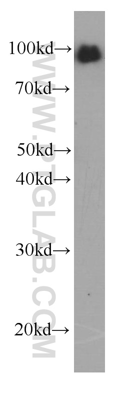 WB analysis of human blood using 60066-1-Ig (same clone as 60066-1-PBS)