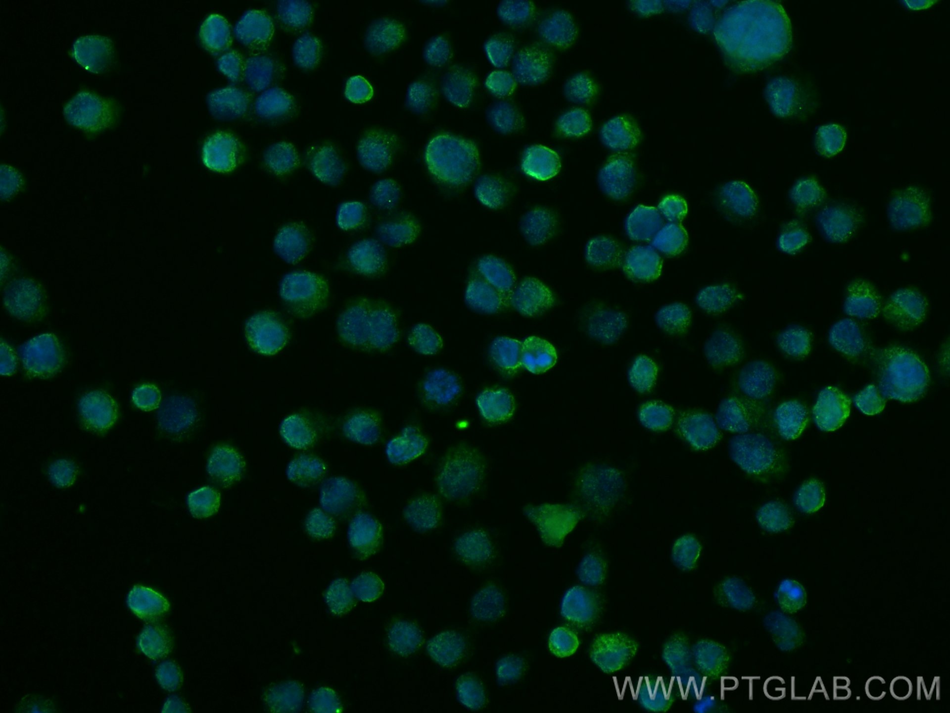 IF Staining of COLO 320 using 13391-1-AP (same clone as 13391-1-PBS)