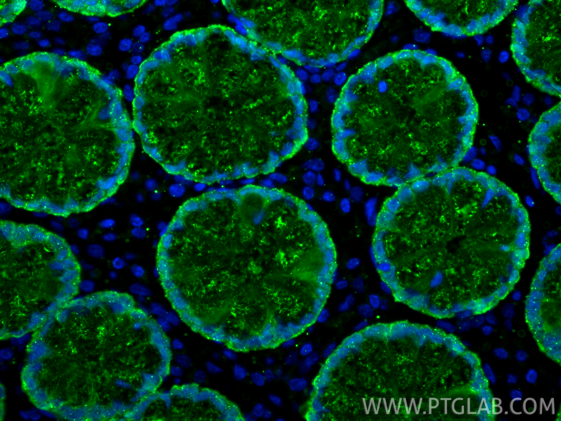 IF Staining of human large intestine using 66686-1-Ig IF Staining of human large intestine using 66686-1-Ig