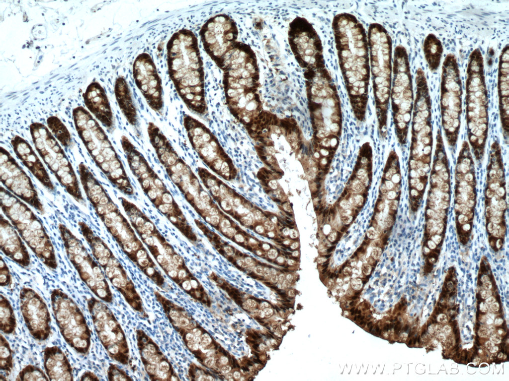 IHC staining of human colon using 66686-1-Ig (same clone as 66686-1-PBS)