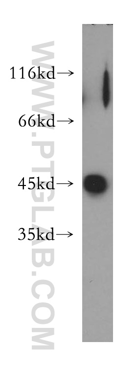 Galectin-9