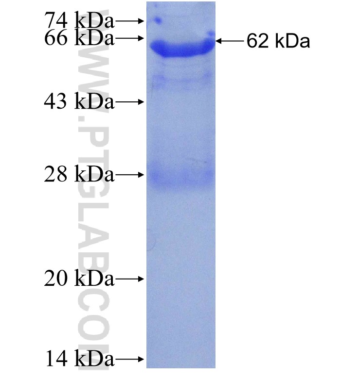 LGALS9, Galectin-9 fusion protein Ag12209 SDS-PAGE