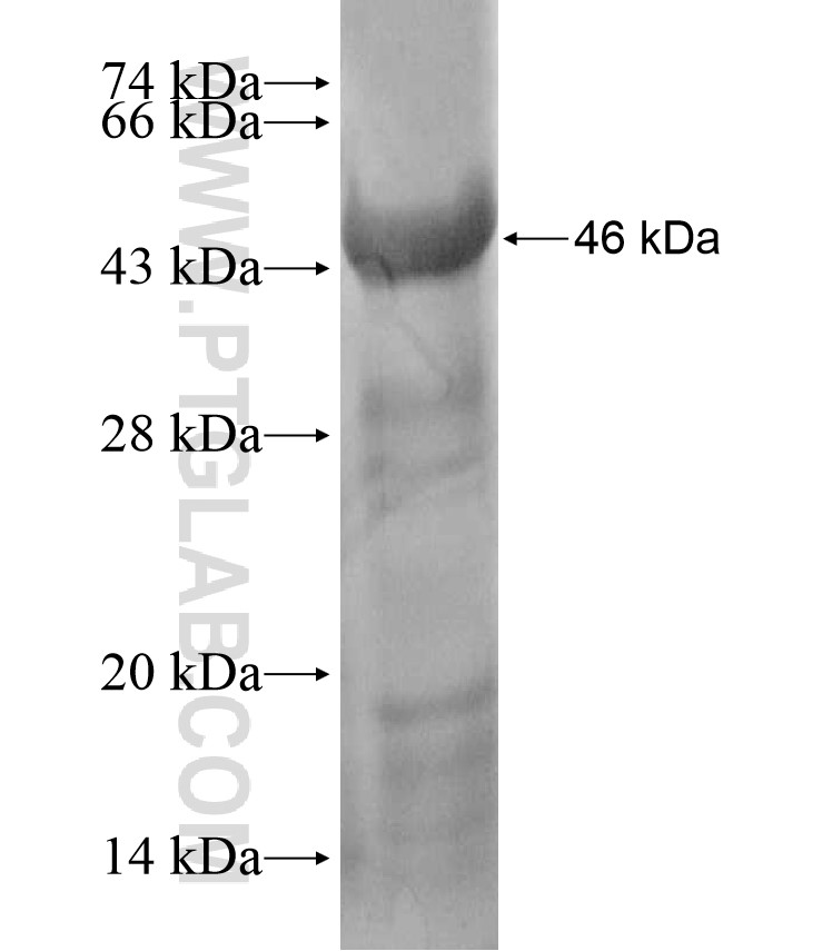 LGI4 fusion protein Ag17720 SDS-PAGE LGI4 fusion protein Ag17720 SDS-PAGE