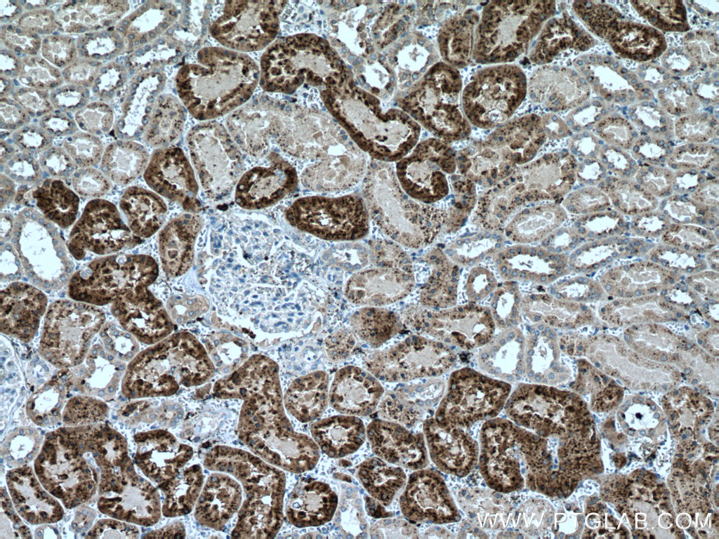 IHC staining of human kidney using 67017-1-Ig