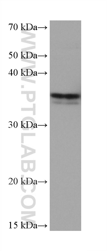 WB analysis of MCF-7 using 67017-1-Ig