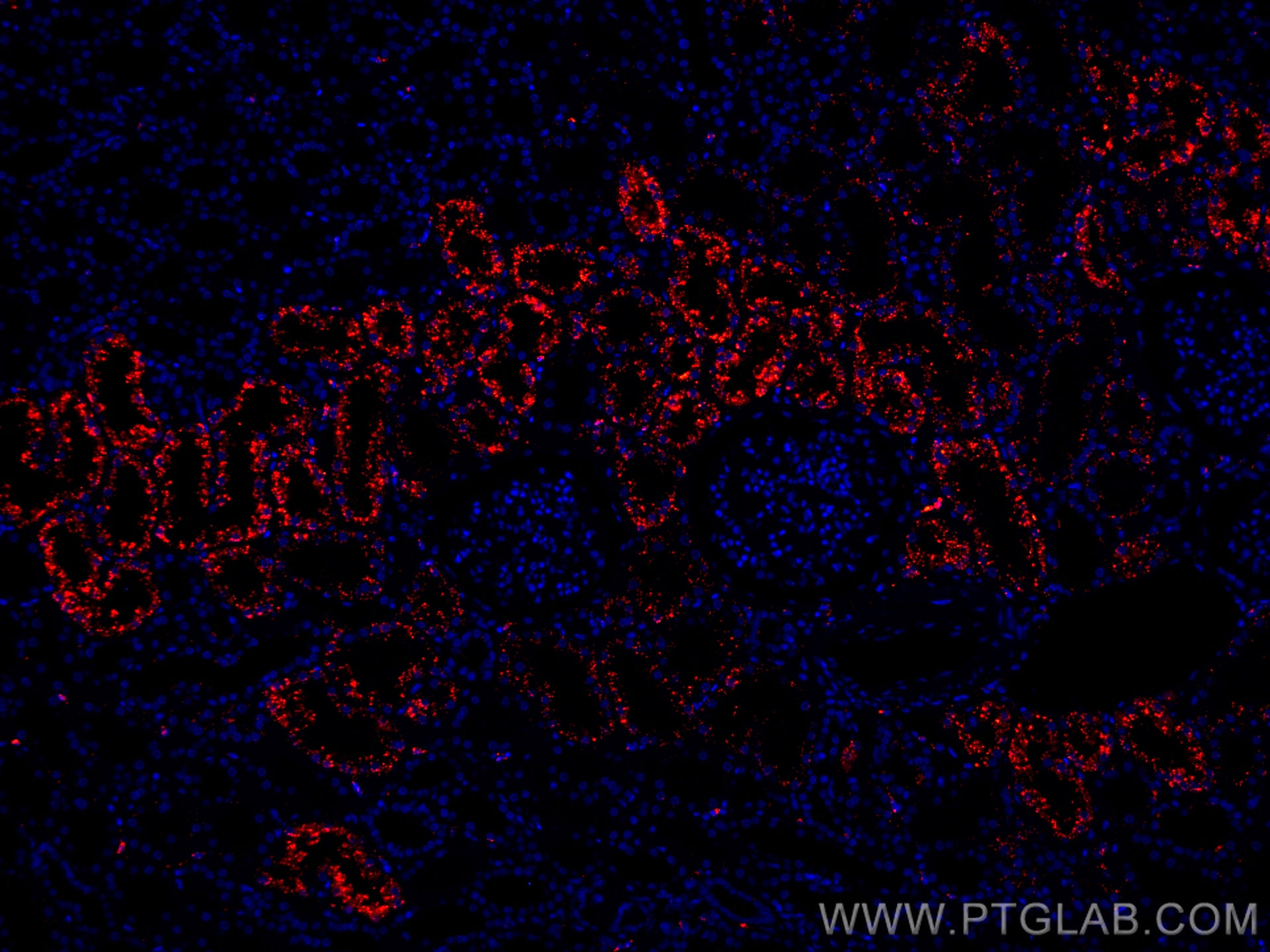 IF Staining of human kidney using CL594-67017